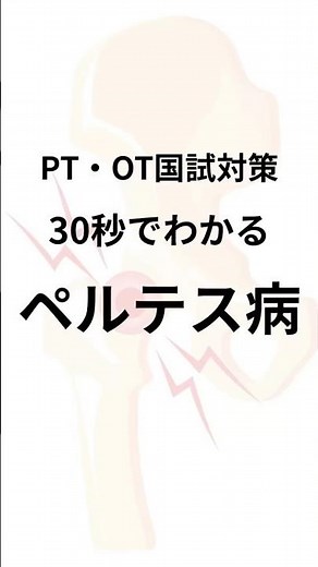 30秒でわかるペルテス病 #shorts #理学療法士 #作業療法士 #国家試験
