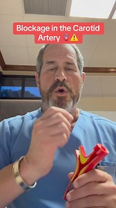 125K views · 3.1K reactions | Heres what to know about a blockage in the Carotid Artery #doctor #surgeon #hearthealth #heartdisease #blockage #fypツ | Dr. Jeremy London, MD | Facebook