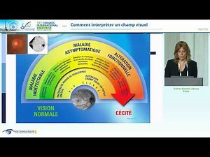 COMMENT INTERPRETER UN CHAMP VISUEL DR ESTHER BLUMEN