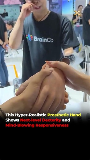Prosthetic Hand With Incredible Responsiveness! 🤯