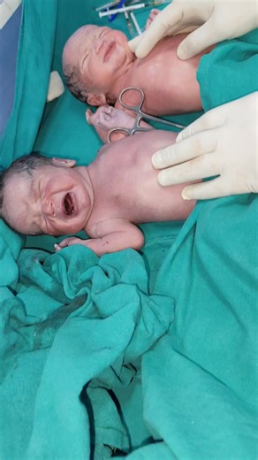 5.3K views · 175 reactions | At birth Newborn twins baby after birth immediate first Cry  baby stable shift to mother side #afterbhirt #cutebaby #fblifestyle #familyfriendly #afterbirthcare #cute #familyfun #fblifestylechallenge #family | Little Angel Care | Facebook