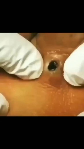 Doc Pimple Popper on TikTok