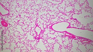 Tissues of lung in section with cells under microscope magnified in 100 times against bright field background. Learning organs of respiratory system and discovering its structure. Concept of medicine.