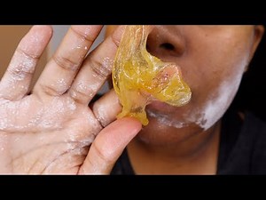 EASY DIY SUGAR WAX FOR BEGINNERS| How to remove facial hair permanently! | PCOS |Keiona Celeste