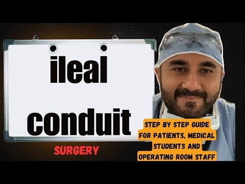 What to Expect for Robotic ileal conduit Surgery 😳(Step by step guide) Must See 👀 ❤️