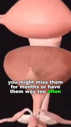 993K views · 6.3K reactions | What is PCOS | Pure Cure | Facebook