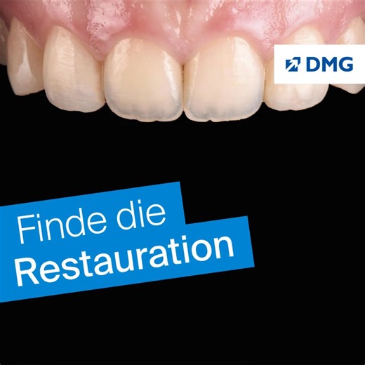 The Modern Art of Composite: Jetzt entdecken! ?️ https://de.dmg-dental.com/loesungen/direkte-fuellungstherapie/composite/ecosite-elements #dmgdental #composite #moderndentistry #zahnfamilie #zahnmedizin | DMG