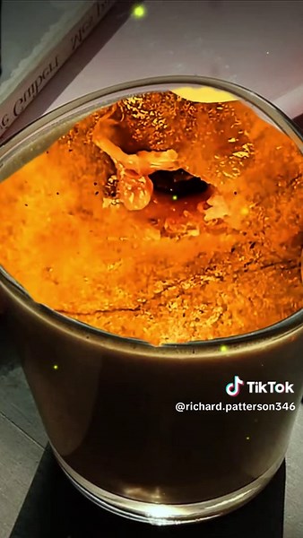 Satisfying Acne Pimple Squeezing Techniques