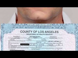 Michael Jackson's morgue photo