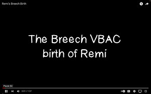 Remi's Breech Birth