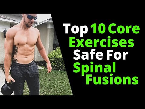 Top 10 Core Exercises Safe For Spinal Fusions