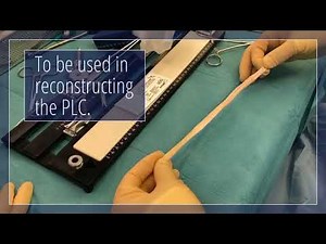 Posterolateral corner (PLC) reconstruction knee surgery using tendon allograft