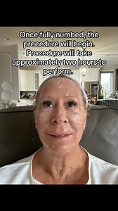 Are you considering the DOT CO2 laser? In this video we will discuss...