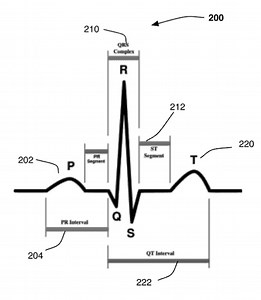 Apple's future iPhones could recognize a user by their heartbeat | AppleInsider