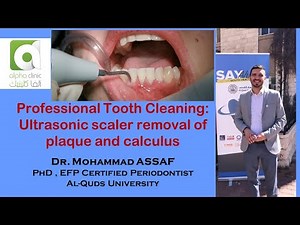Ultrasonic scaling of teeth - Removal of dental calculus and plaque - Full mouth debridement