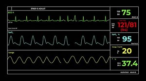 CGI video of screen of medical equipment with integrated systems of monitoring vital parameters