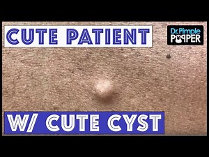 ReCYSTance is Futile... with Dr Pimple Popper