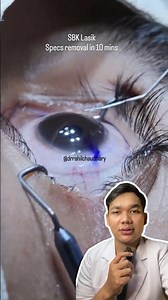 Bagaimana Operasi Lasik Mata Dilakukan?