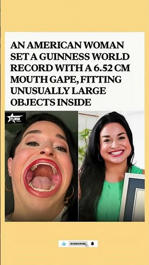 This American Woman Broke A Guinness World Record With The Widest Mouth Gape Ever #shorts #amazing