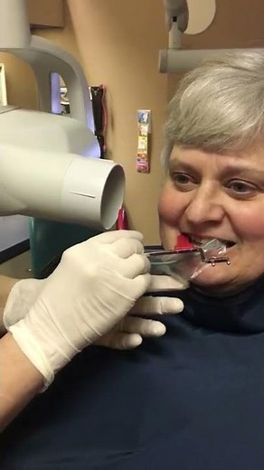 Right bicuspid bitewing