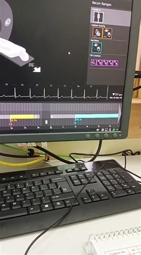 CT Scan operator console.