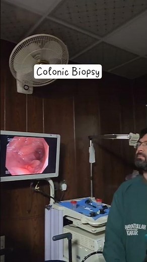 Colonic Biopsy During Colonoscopy | Endoscopy Technician Procedure #colonoscopyawareness