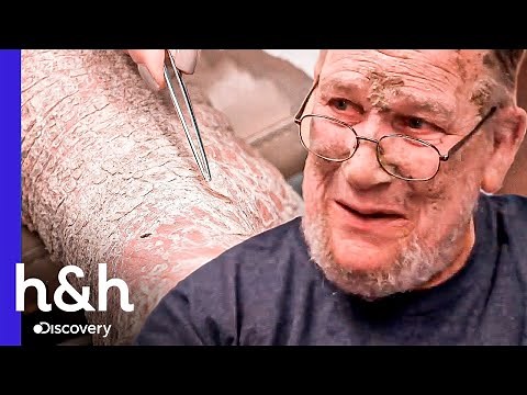 "¡Esto es un misterio para mi!" | Dra. Sandra Lee: Especialista en piel | Discovery H&H