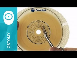 Preparing a 2-piece SenSura Flex barrier