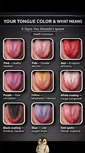 What Your Tongue Color Says About Your Health 9 Warning Signs Explained