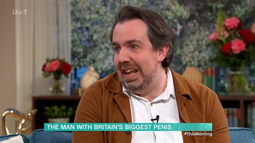 Man with 'biggest penis in Britain' reveals it comes with problems