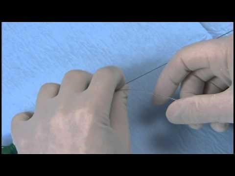 Angioplasty technique: insertion of a balloon catheter