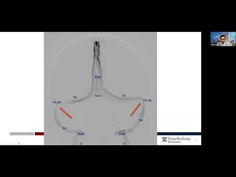 Venous Manometry Explained