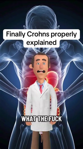 Understanding Crohn's Disease: A Comprehensive Guide