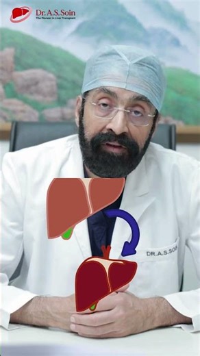 Liver Transplant में Regeneration कैसे होता है? Dr A.S Soin #livercare #liverdoctor #livertreatment