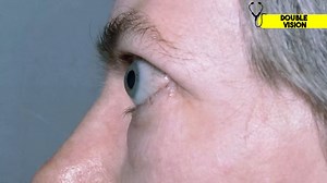 Doctor reveals 19 physical clues of hyperthyroidism