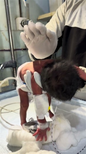 Chestryp for newborn baby 😊👍 #you #youtubeshorts #newbornbaby #nursing #chestworkout #viralvideo