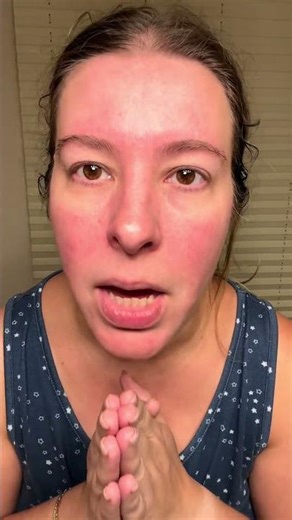 Week 3 on Soolantra: Redness Improving, Texture Better! #soolantra