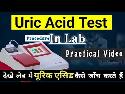 Uric Acid Test | Uric Acid Test Procedure In Lab