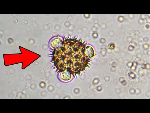 10 Crazy Things Seen Under Microscope