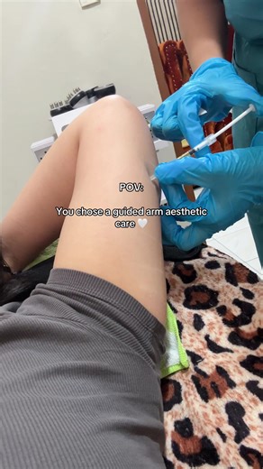 Guided Arm Aesthetic Care for Beautiful Arms