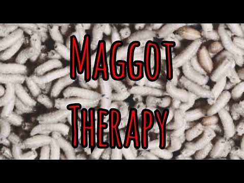 Prolonged Field Care Podcast 175: Maggot Therapy