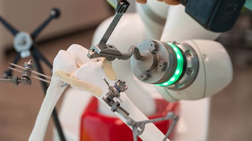 Robotic knee surgery with the robot system "ROBIN" at a new level | KUKA Global