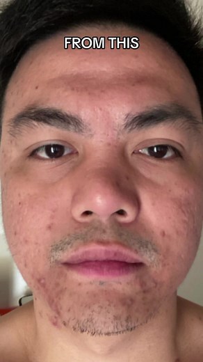 Boost up your confidence with Software’s custom skincare ✨ #skinsoftware #software #skincare #fyp #auskincare