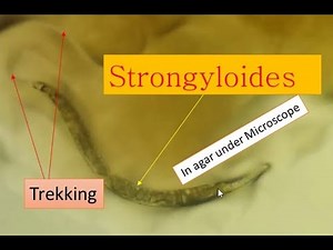 Strongyloidiasis cause and its pathogenesis ||Strongyloides under microscope