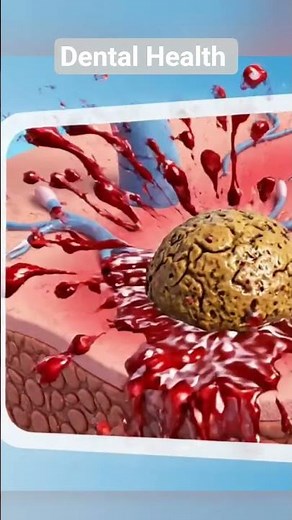 “How Cold Sores Form: A 3D Medical Animation”