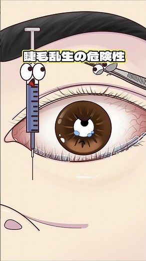 睫毛乱生の危険性