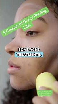 Why my lips are dry or peeling? #drylips #peelinglips #doctorexplains