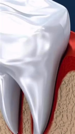 Ace Dental Specialties on Instagram: "What is Root Canal Therapy? Root canal therapy is a treatment used to save a tooth that is badly decayed, infected, or severely damaged. Instead of removing the tooth, your dentist removes the infected pulp inside, cleans and disinfects the root canals, and then seals it to prevent future infection. ⸻ 🦷 Why You Might Need a Root Canal: • Tooth pain that doesn’t go away • Sensitivity to hot or cold • Swelling or tenderness near the gums • A darkened or crack