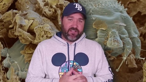 25 insects that call human bodies their home