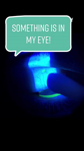 Foreign Body Removal from Eye: What to Expect
